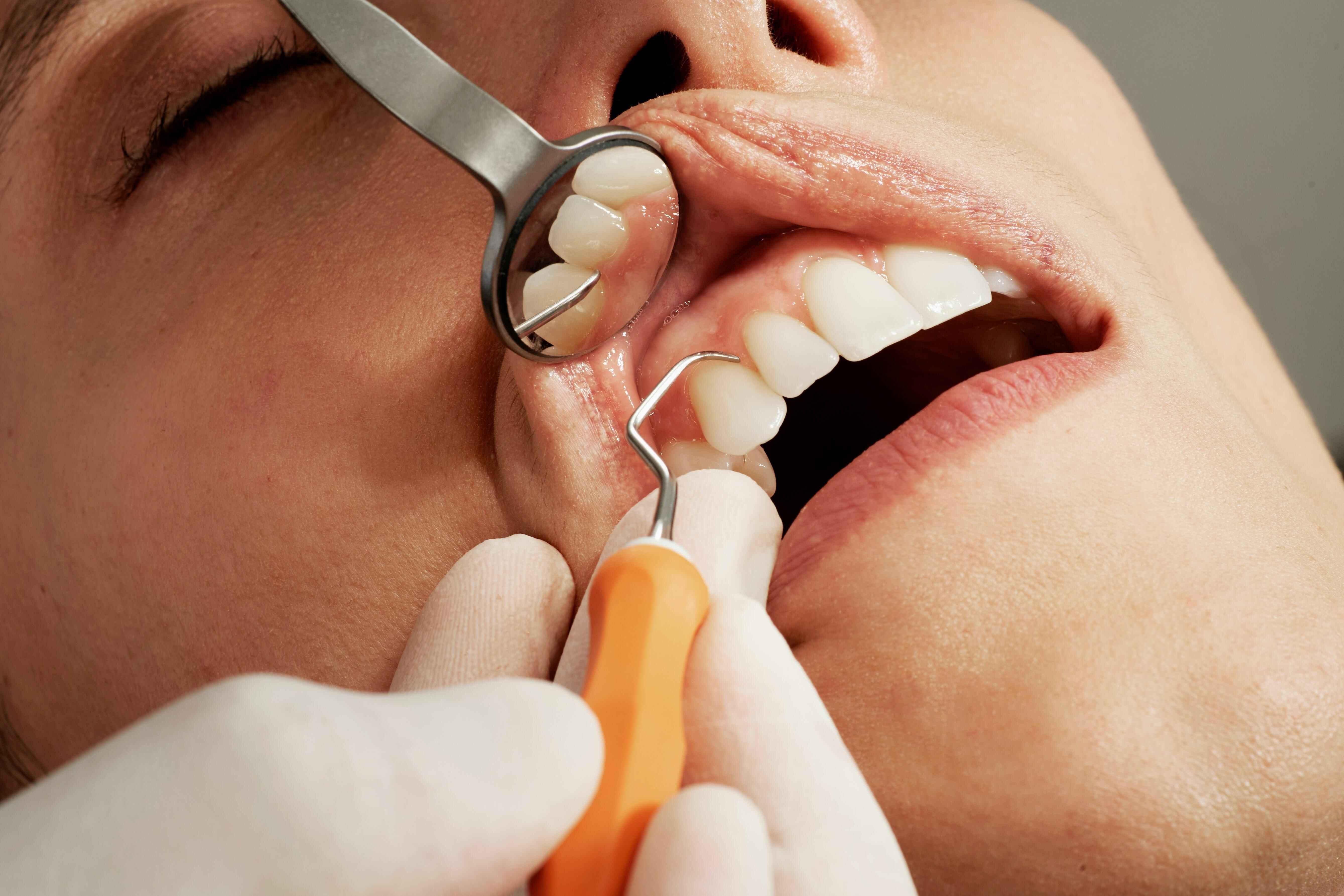 Dentist working on a patient